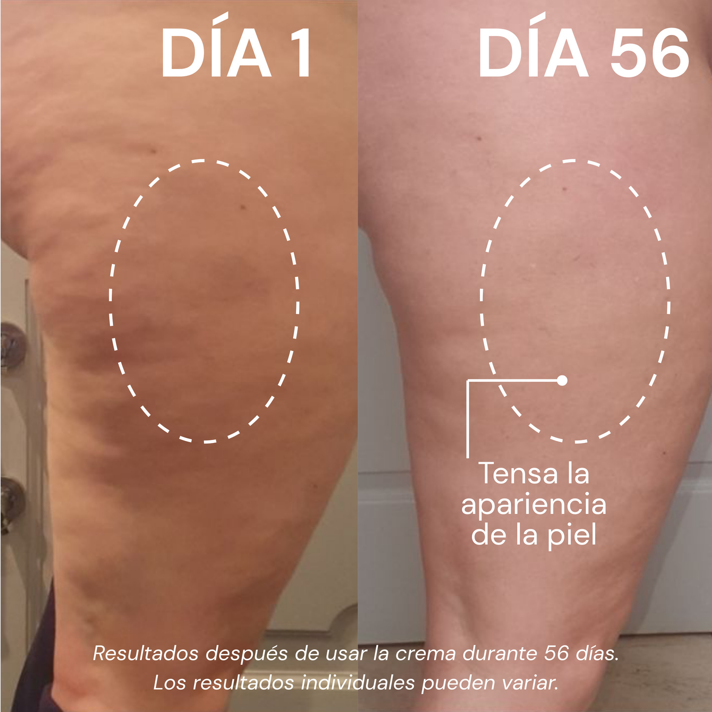 Crema Reafirmante Anticelulitis, Flacidez y Estrías