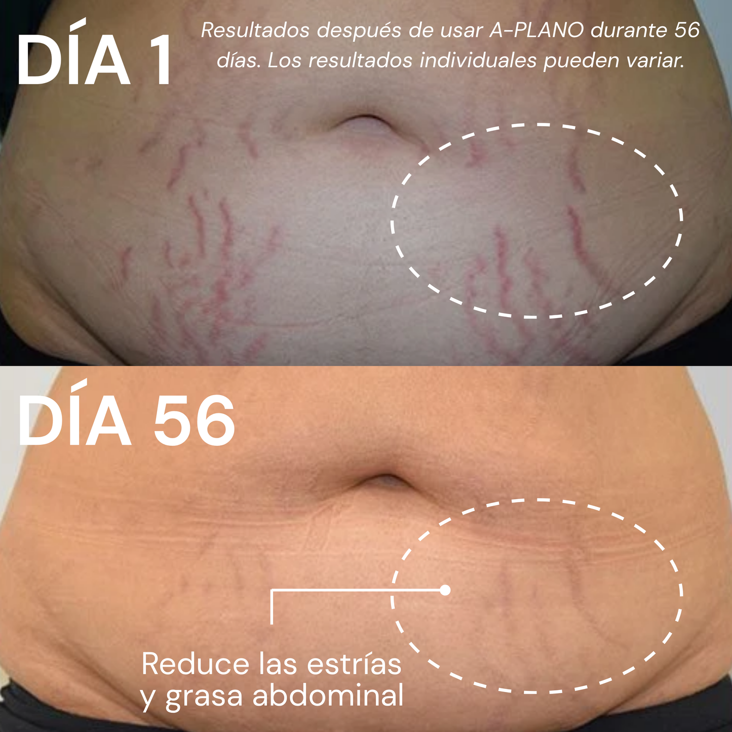 A-PLANO Crema Reafirmante Con Efecto Reductor Para Abdomen
