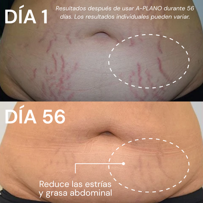 A-PLANO Crema Reafirmante Con Efecto Reductor Para Abdomen